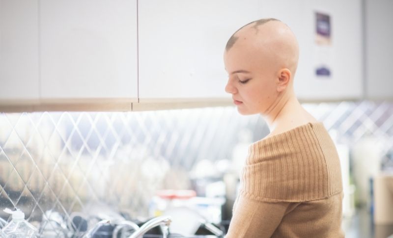 Androgenetic alopecia in women overview - Pattern hair loss