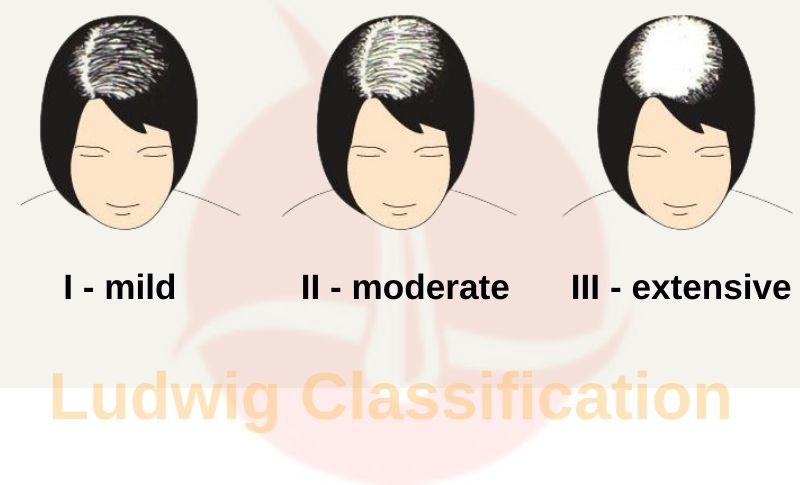 Ludwig Classification - Scale
