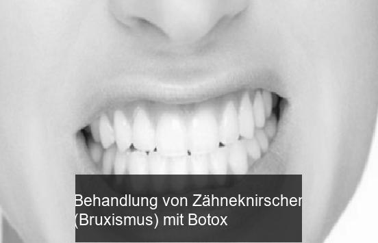 Behandlung von Zähneknirschen (Bruxismus) mit Botox