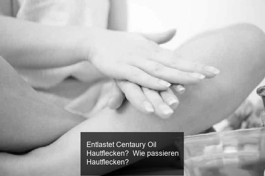 Entlastet Centaury Oil Hautflecken? Wie passieren Hautflecken?