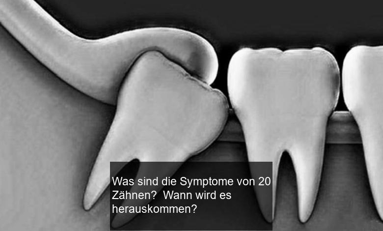 Was sind die Symptome von 20 Zähnen? Wann wird es herauskommen?